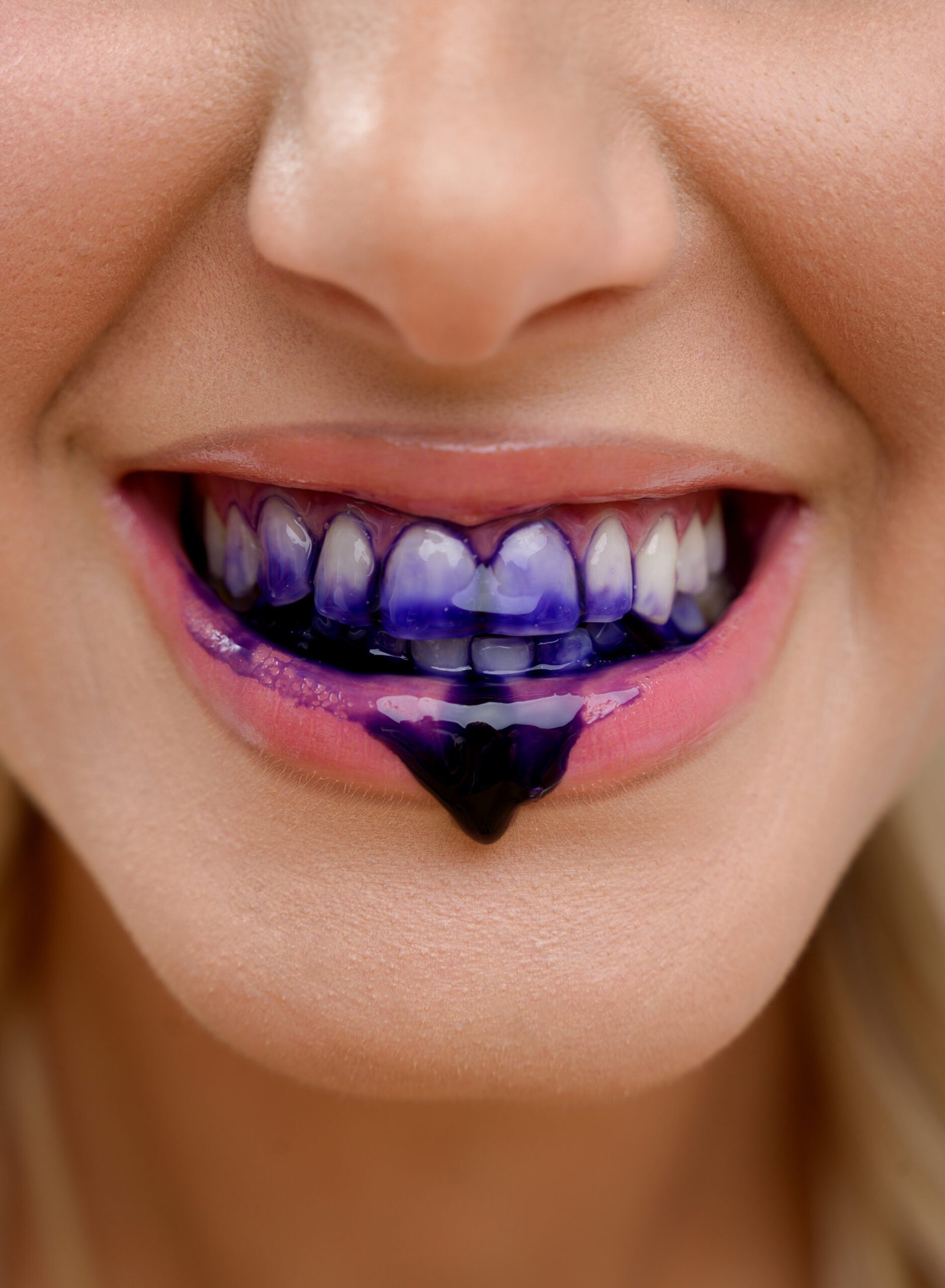 Προϊόντα PAP που εφαρμόζονται στα δόντια